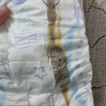 Molfix 6 Numara Bebek Bezi Şikayeti