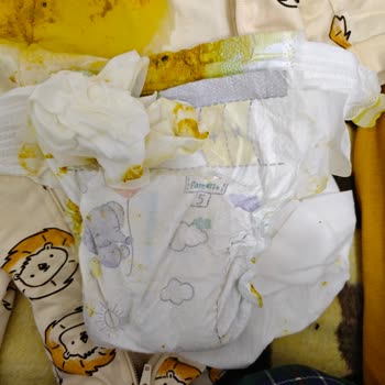 Prima 5 Numaralı Bebek Bezinde Sızdırma Sorunu Ve Mağduriyet Talebi