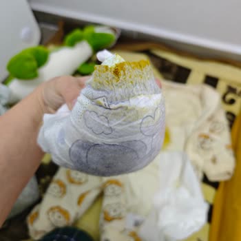 Prima 5 Numaralı Bebek Bezinde Sızdırma Sorunu Ve Mağduriyet Talebi