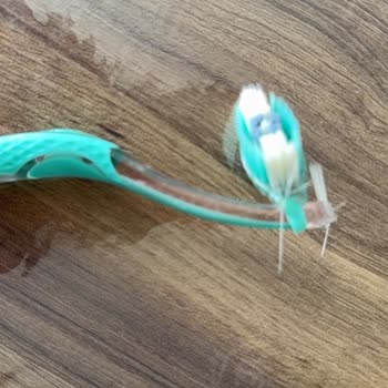 Signal Diş Fırçası Kırıldı, Ağızda Şişlik Ve Yaralanma