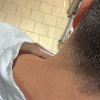 Şef Ceketi Birkaç Yıkamada Yırtıldı, İade Ve Hizmet Sorunu