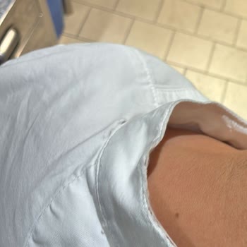 Şef Ceketi Birkaç Yıkamada Yırtıldı, İade Ve Hizmet Sorunu