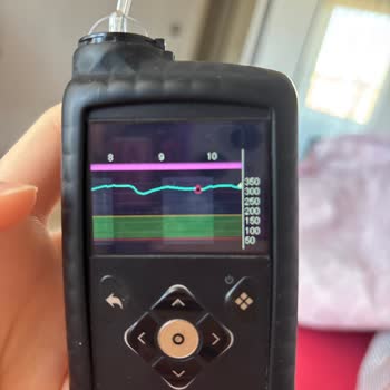 Medtronic İnsülin Pompası Setinde Yaşanan Kritik Sorun Ve Sağlık Riski