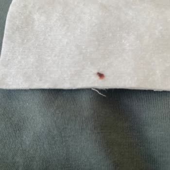 E-Bebek Kavacık Şubesinde Satılan Baby Me Bebek Pamukları İçinde Kanlı Madde Çıktı