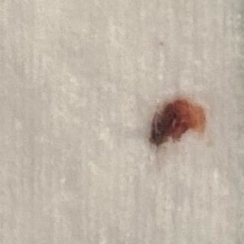E-Bebek Kavacık Şubesinde Satılan Baby Me Bebek Pamukları İçinde Kanlı Madde Çıktı