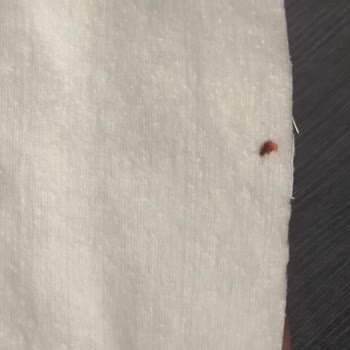 E-Bebek Kavacık Şubesinde Satılan Baby Me Bebek Pamukları İçinde Kanlı Madde Çıktı