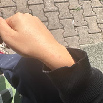 Tahta Kurusu Enfekte Yatak Başlığı İçin İade Ve Değişim Talebi