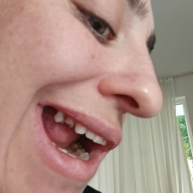 Antalya Meltem Diş Hastanesi Şikayeti