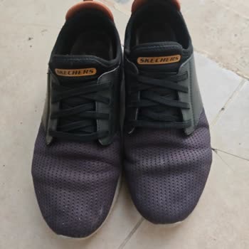 Skechers Ayakkabısında Kısa Sürede Deformasyon Ve Boyner Mağazasının Olumsuz İncelemesi
