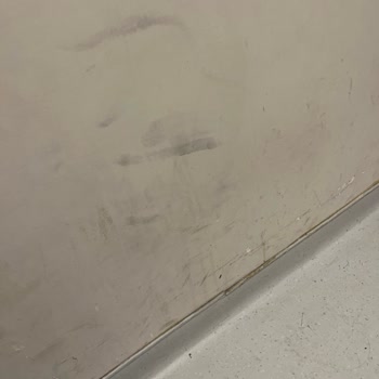 Adana Devlet Hastanesi Çocuk Servisinde Hijyen Eksikliği Ve Tehditkar Söylemler