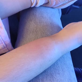 Doğada Bir Gün'de Çocukların Beslenme, Tuvalet Ve Sağlık İhmaline Karşı Şikayet
