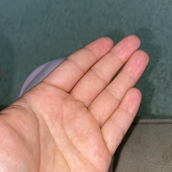 Waffle’da Saç Bulunması Ve Müşteri Şikayetine Cevap Gelmemesi