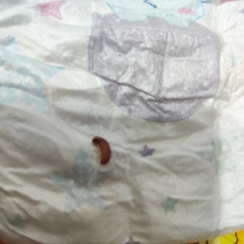 Molfix Bebek Bezinde Kurtlu Hijyen Sorunu Ve Cevapsız İletişim