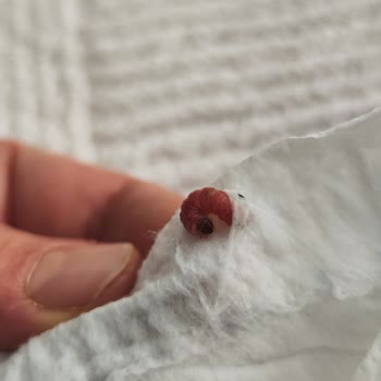 Molfix Bebek Bezinde Kurtlu Hijyen Sorunu Ve Cevapsız İletişim