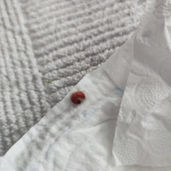 Molfix Bebek Bezinde Kurtlu Hijyen Sorunu Ve Cevapsız İletişim