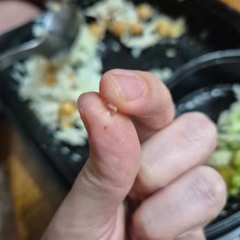 Yemeksepeti Gecce Pilav'dan Gelen Pilavda Cam Parçası Ve Sağlık Riski