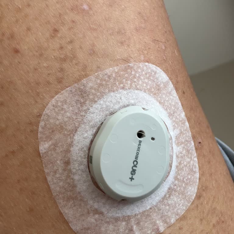 Çalışmayan Dexcom Sensörü ve Saygısız Müşteri Temsilcisi Üzerine Acil Çözüm Talebi