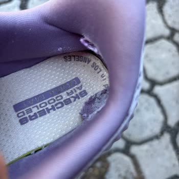 Skechers Ayakkabısının Kısa Sürede Yırtılması Ve Kullanıcı Hatası Reddi