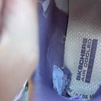 Skechers Ayakkabısının Kısa Sürede Yırtılması Ve Kullanıcı Hatası Reddi