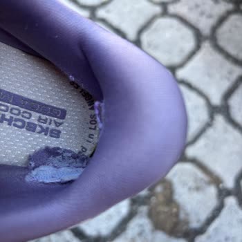 Skechers Ayakkabısının Kısa Sürede Yırtılması Ve Kullanıcı Hatası Reddi