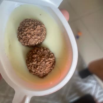 Kinder Sürpriz Yumurtasında Çikolatada Kıl Bulunması Gıda Güvenliği İhlali