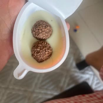 Kinder Sürpriz Yumurtasında Çikolatada Kıl Bulunması Gıda Güvenliği İhlali