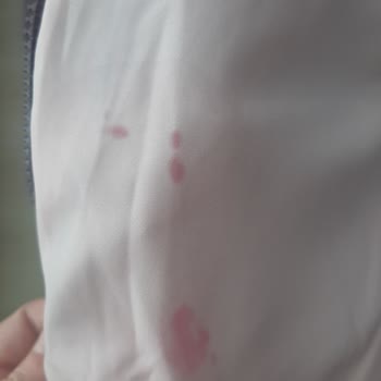 Zara’dan Gelen Defolu Mont İçin Hızlı Değişim Talebi