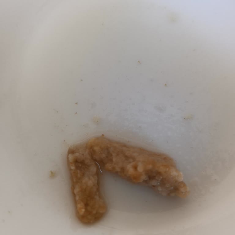 Kellogg’s Kırmızı Meyveli Mısır Gevreğinde Çiğ Et Parçası: Hijyen Ve Sağlık Endişesi