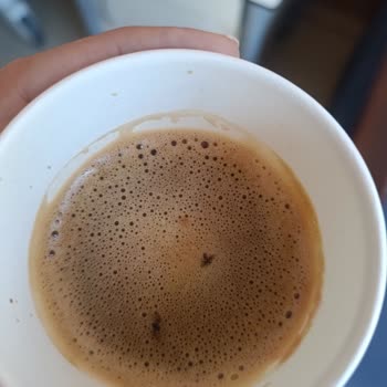 Hastane Otomatik İçecek Makinesinde Sütlü Kahvede Sinekler Hijyen Sorunu