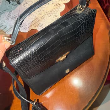 Beymen Çanta Sapı Kırıldı, Tamir İmkansız Diyor: Hayal Kırıklığı