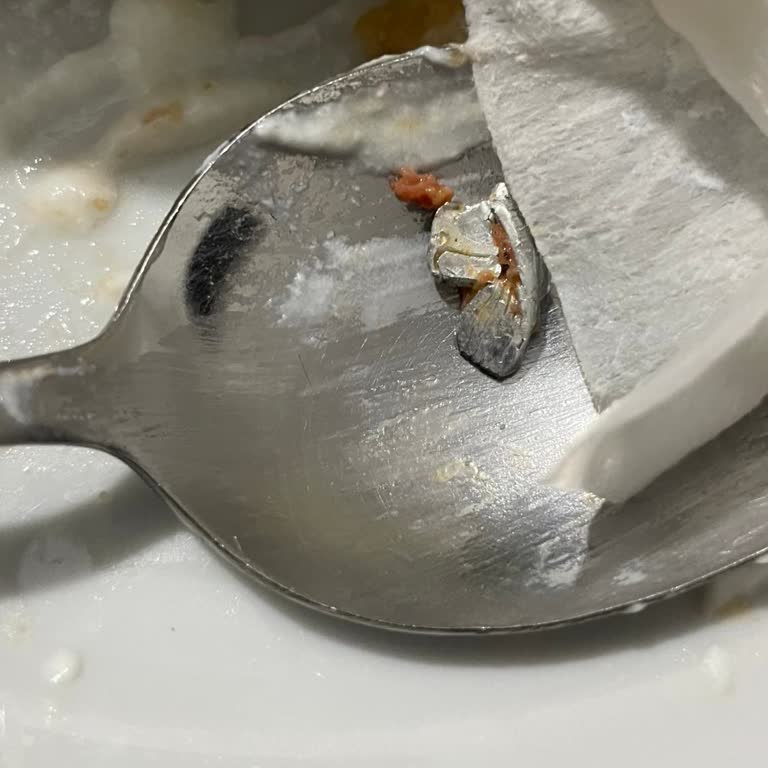 Migros Şubesinden Alınan Sucuğun İçinde Metal Parça Çıktı Sağlık Riski Oluşturdu