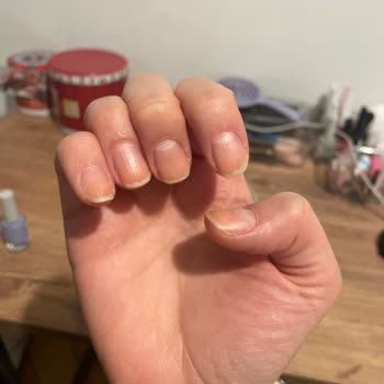 Gratis Mağazasında Satın Alınan Beaulis Ojesinde Tırnak Sararması Ve Kalite Şikayeti