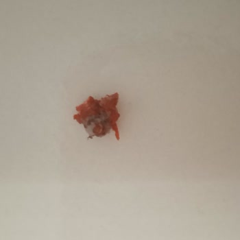 Köfteci Yusuf Güzelce Şubesinde Et Ürününde Plastik Parça Tespiti