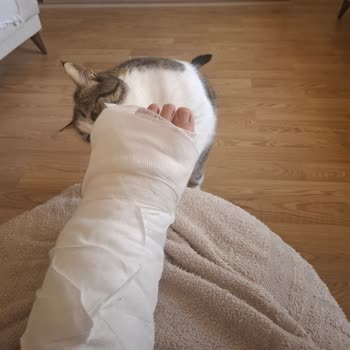 Ayakkabı Uyum Bilgisi Eksikliği Nedeniyle Ayak Kırığı Ve Geri Dönüş Sürecinin Gecikmesi