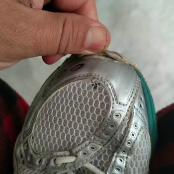 Asics Nimbus Ayakkabısında Garanti Kapsamı Reddedildi Ve Para İadesi Talep Edildi