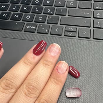 Base Coat Kullanımı Nedeniyle Tırnaklar Çabuk Döküldü Ve İade Reddi