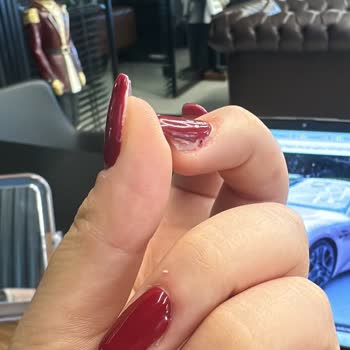 Base Coat Kullanımı Nedeniyle Tırnaklar Çabuk Döküldü Ve İade Reddi