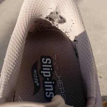 Skechers Ayakkabısındaki Erken Deformasyon Ve Mağaza İle Müşteri Hizmetlerinden Destek Alamama
