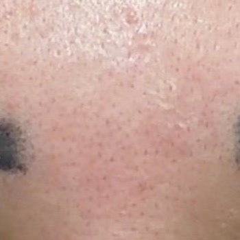 Muse Brows & Lashes Kaş Pudralama İşleminde Yanlış Renk Ve Müşteri Hizmetinde İhmalkârlık