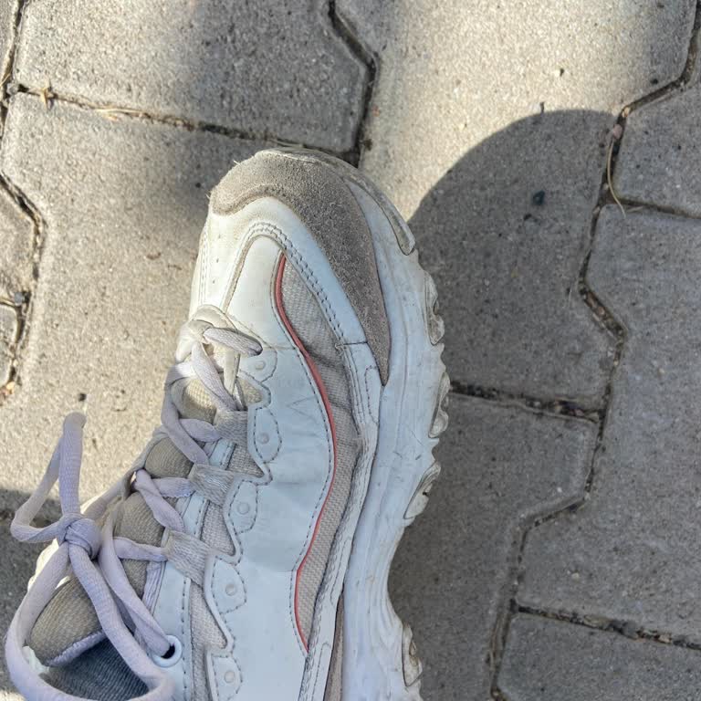 Skechers Ayakkabıda Kısa Sürede Yan Kenarlarda Atma Ve Açılma Sorunu