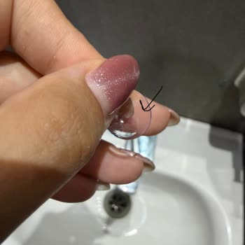Acuvue Oasys Lenslerde Beyaz Lekeler Göz Ağrısı Ve Görüş Bozukluğuna Yol Açıyor