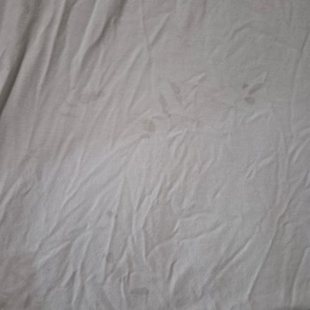 Profilo Çamaşır Makinesinde Tekrarlayan Leke Sorunu Ve Yetkili Servis Yetersizliği