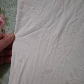 Profilo Çamaşır Makinesinde Tekrarlayan Leke Sorunu Ve Yetkili Servis Yetersizliği