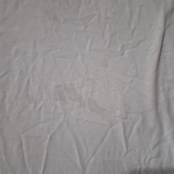 Profilo Çamaşır Makinesinde Tekrarlayan Leke Sorunu Ve Yetkili Servis Yetersizliği