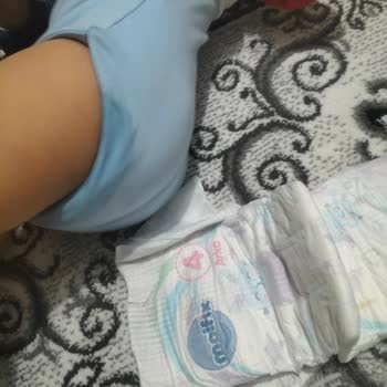 Molfix 4 Numara Bebek Bezi Sızdırma Ve Pişik Sorunu