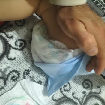 Molfix 4 Numara Bebek Bezi Sızdırma Ve Pişik Sorunu
