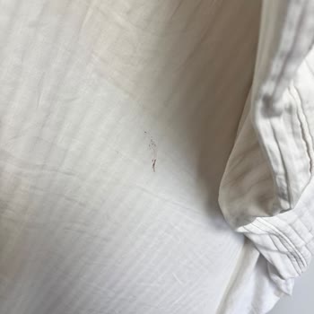 Güner City Hotel’de Hijyen Aşaması Olmayan Oda Şikayeti Ve İade Talebi
