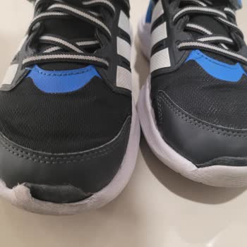 Adidas Çocuk Ayakkabısında Kısa Sürede Deformasyon Ve Ücret İadesi Talebi
