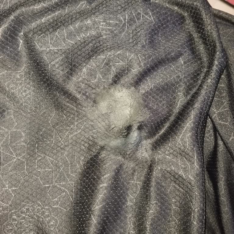 Yeni Formada Yanık Ve Aşınma, Müşteri Hizmetlerinden Cevap Yok