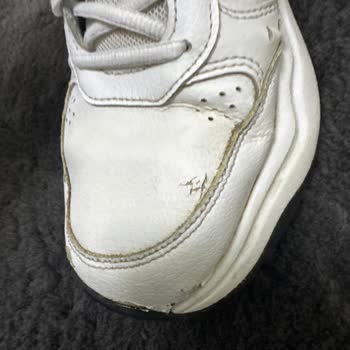Adidas Strutter Ayakkabısının Kısa Sürede Açılma Ve Soyulma Sorunu İade Reddedildi